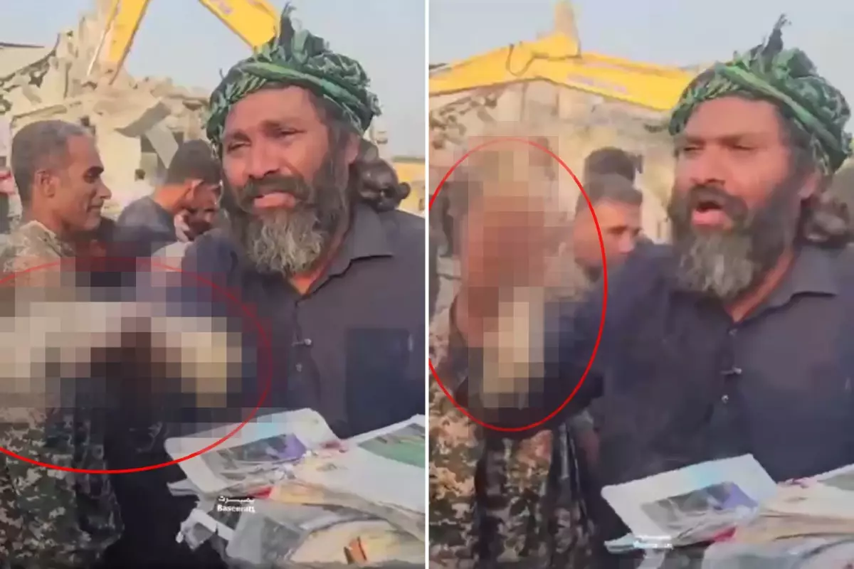 İran\'da İlkokulda öldürülen kız çocuğunun kopan elini gösterip isyan etti: Dünya bu cinayeti görmeli