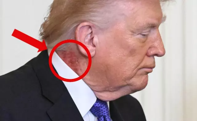 Herkes Trump'ın boynundaki yaraya odaklandı Herkes Trump'ın boynundaki yaraya odaklandı