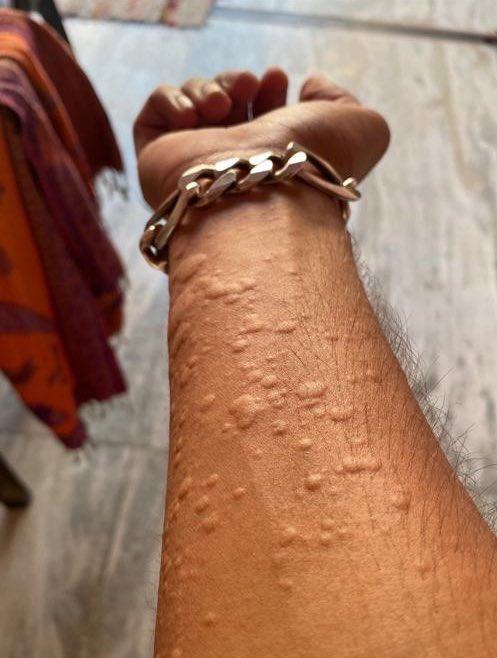 'Erkek arkadaşımı ziyaret ettim' diyen kadın, bu fotoğrafı paylaşıp yardım istedi