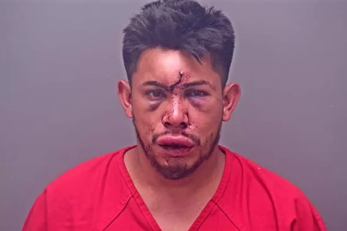 13 yaşındaki çocuk, evdeki olayı görünce babasını bu hale getirdi