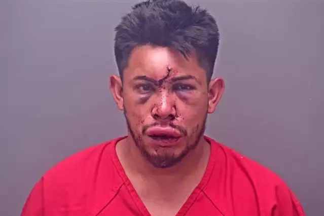 13 yaşındaki çocuk, evdeki olayı görünce babasını bu hale getirdi