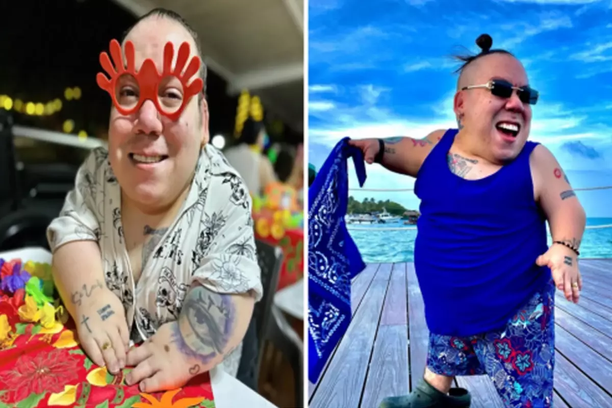 Cüce fenomen Alejo Little hayatını kaybetti, son paylaşımı yürek burktu