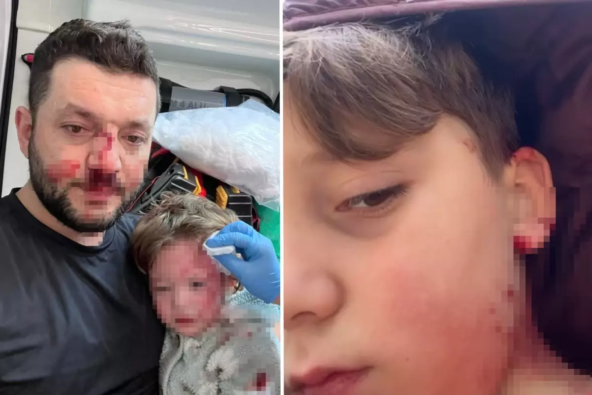 Yalova'da Saldırı ve Tehditler Devam Ediyor