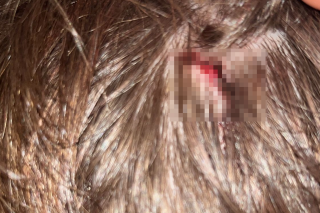 Yalova'da husumet büyüyor: Aynı ailenin 8 yaşındaki çocuğu da yaralandı