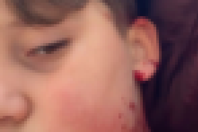 Yalova'da husumet büyüyor: Aynı ailenin 8 yaşındaki çocuğu da yaralandı