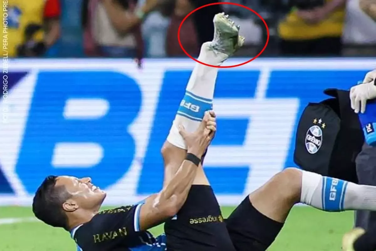 Süper Lig\'in eski yıldızı ayağını kırdı 