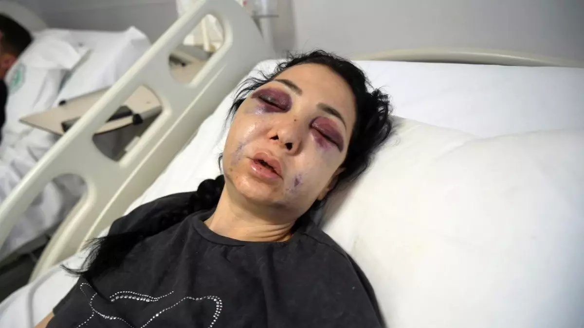 Oğlunun gözü önünde anneyi öldüresiye dövdüler: "\'Küfür etmeyin\' dedik diye bu hale geldim"