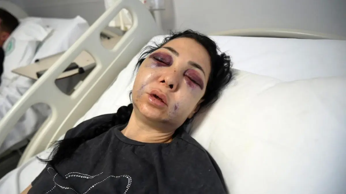 Bayramda Feci Darp: 1 Tutuklama