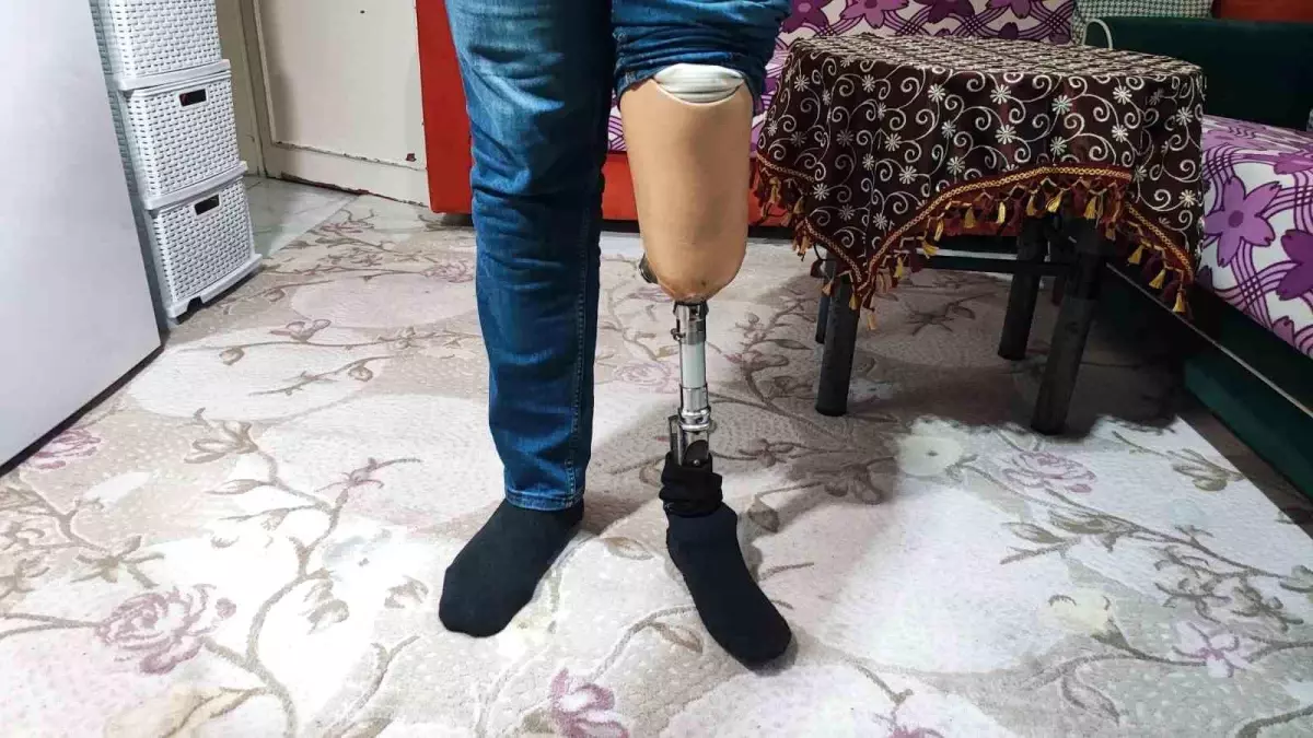 Protez Bacaklı Temizlik Görevlisi Dolandırıcılıktan Hapis Cezası Aldı