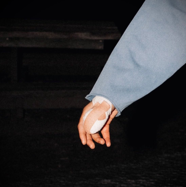 İşte Noa Lang'ın parmağının son hali