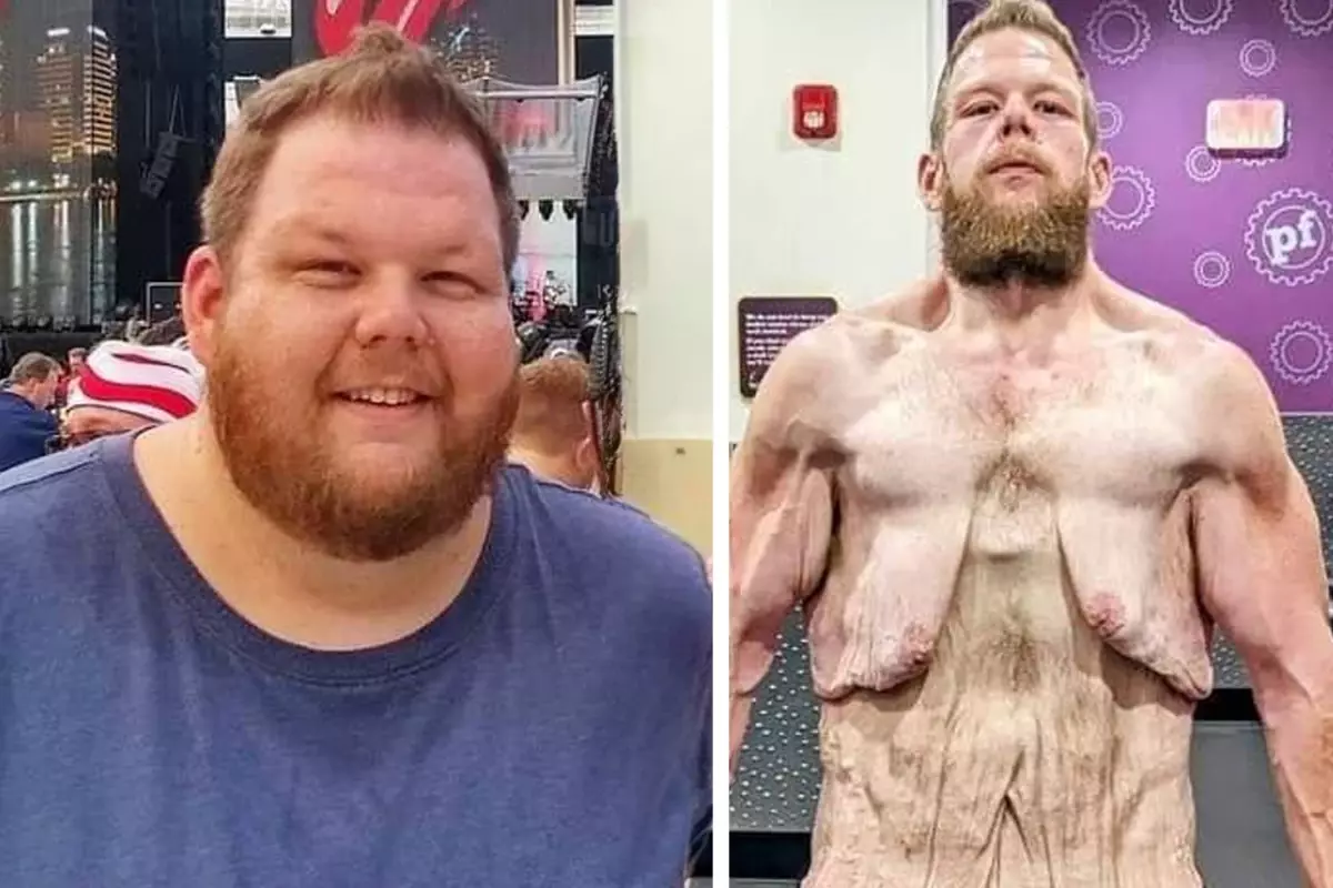 163 kilo verdi ama çilesi bitmedi