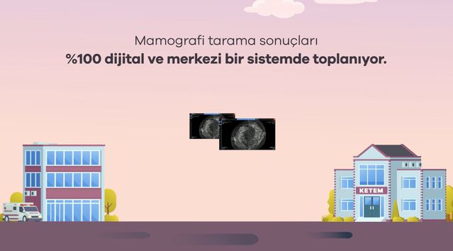 Meme Kanseriyle Mücadelede Yeni Sistem