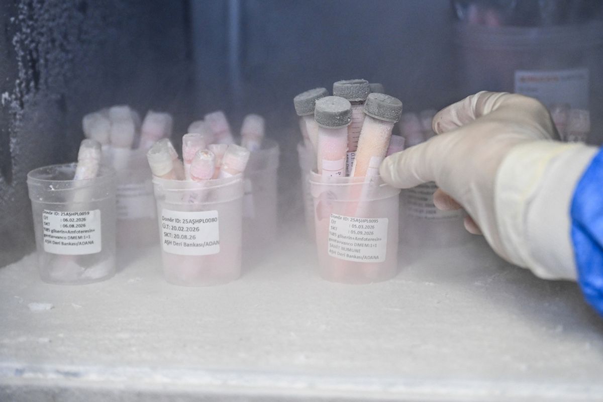 Türkiye\'nin tek deri bankası ve doku laboratuvarına bağışlar artıyor