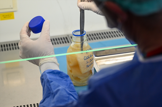 Türkiye'nin tek deri bankası ve doku laboratuvarına bağışlar artıyor