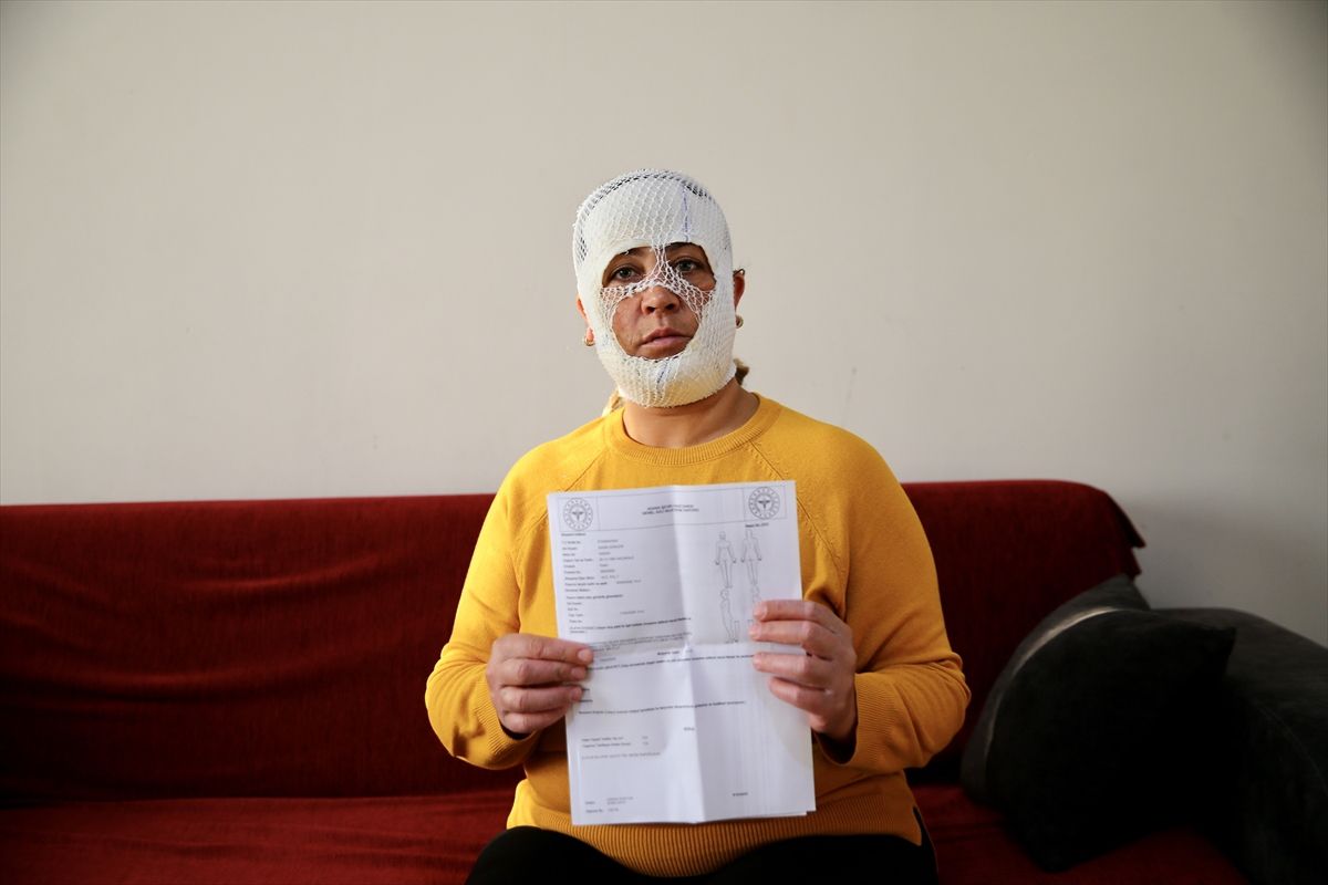 Güzellik Merkezine Şikayet: Yüzünde Yanık