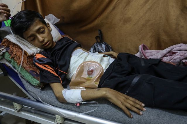 İsrail Saldırısında Yaralanan Çocuğun Hayat Mücadelesi