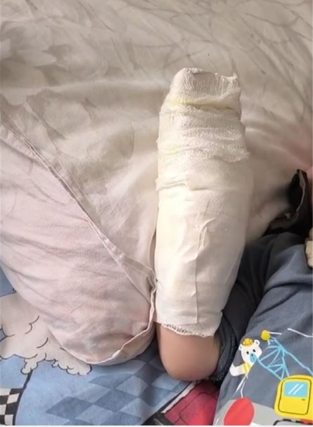 AVM'de yürüyen merdivene eli sıkışan çocuğun parmağı koptu