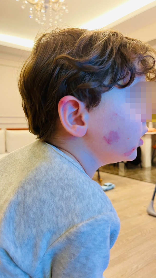 Kreşe bıraktığı çocuğunu darp edilmiş halde aldı