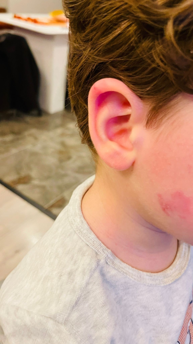 Kreşe bıraktığı çocuğunu darp edilmiş halde aldı