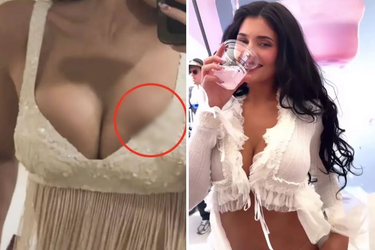 Milyonlarca hayranı bu sorunun cevabını arıyor: Kylie Jenner’ın silikonu mu patladı?