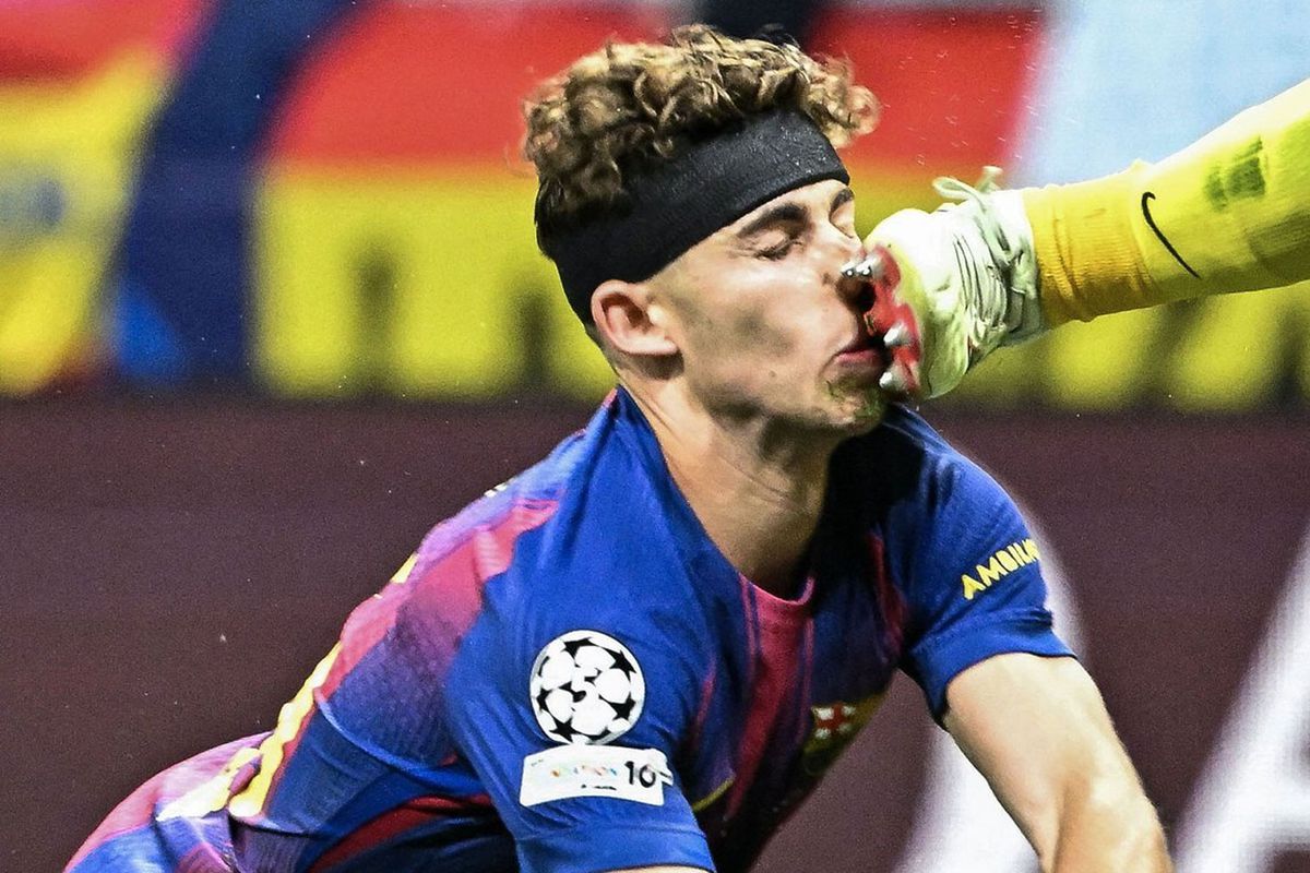 Atletico Madrid-Barcelona ma&ccedil;ında y&uuml;rekleri ağza getiren sakatlık