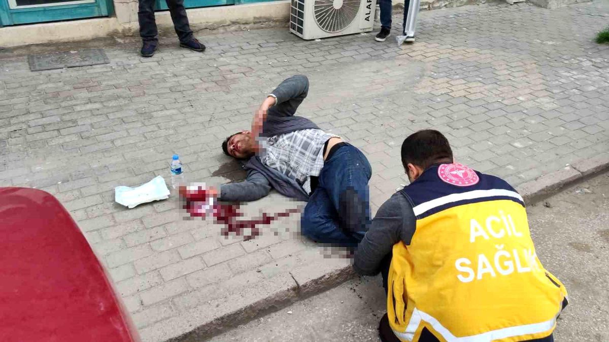 Aksaray\'da Bıçaklı Kavga: Genç Yaralandı