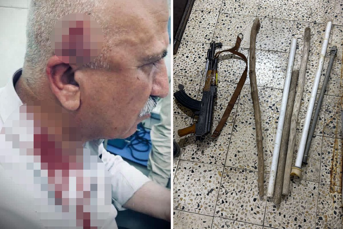 Kerkük\'te kaçak yapı yıkımı sırasında kaymakama bıçaklı ve sopalı saldırı