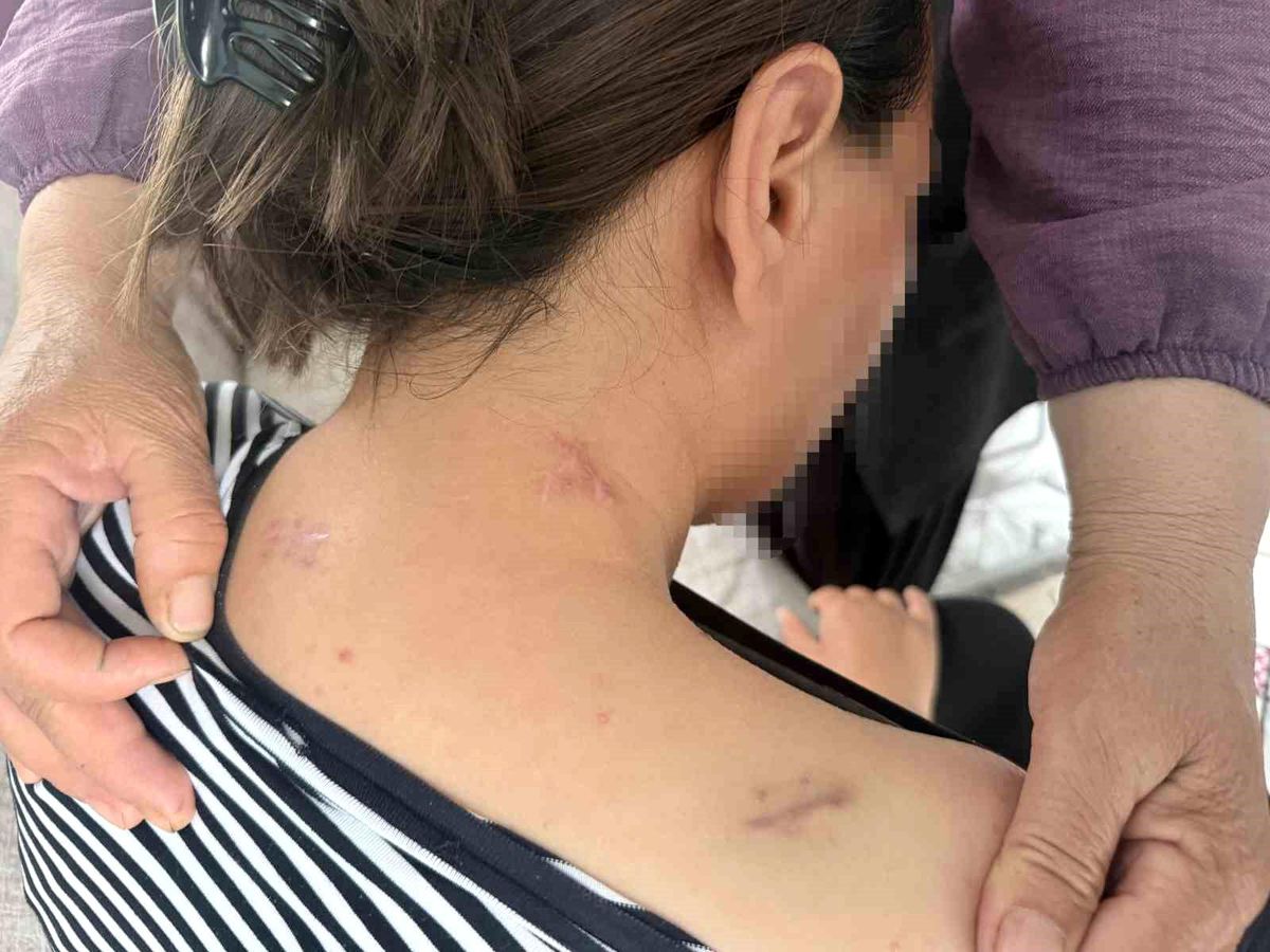 Mersin\'de Kadına Şiddet: 17 Bıçak Darbesiyle Kurtuldu