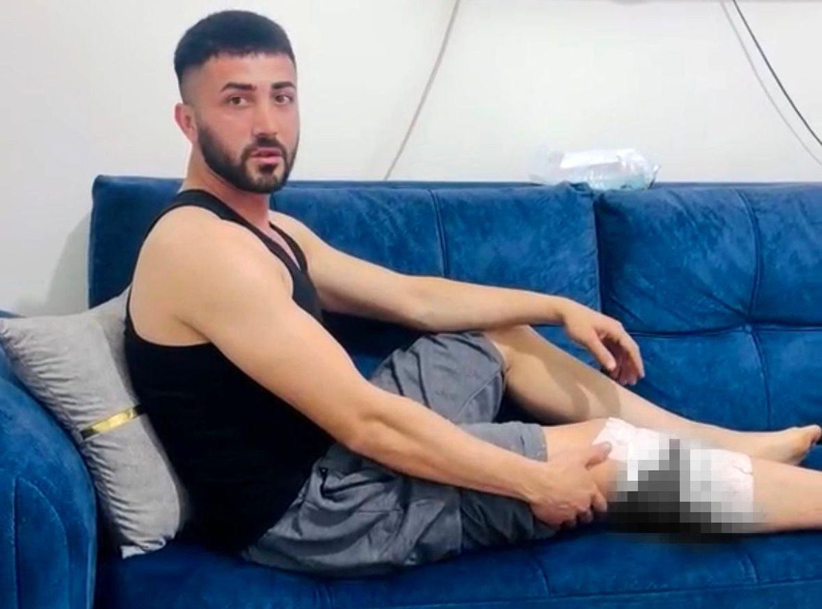 Nizip\'te başıboş köpek saldırısında yaralanan 2 kişi belediyeye tepki gösterdi