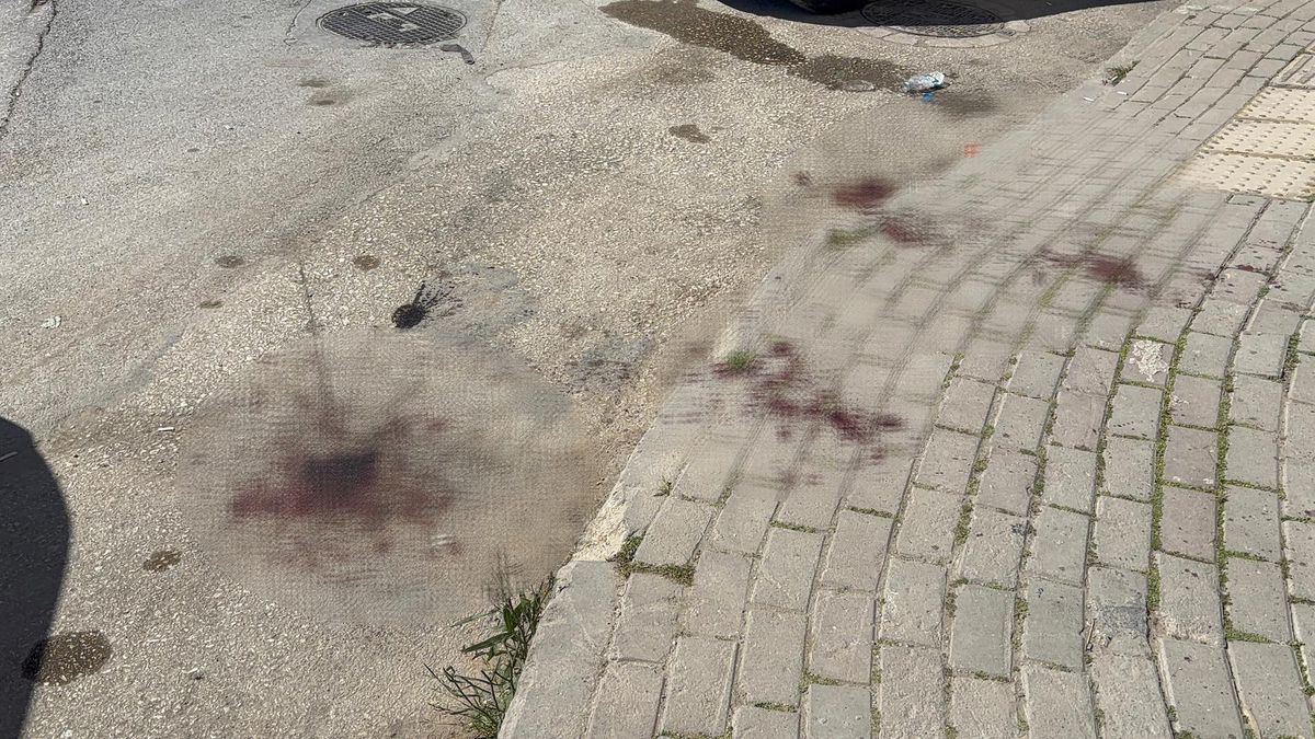 Sosyal Medya Fenomeni Bıçakla Yaraladı