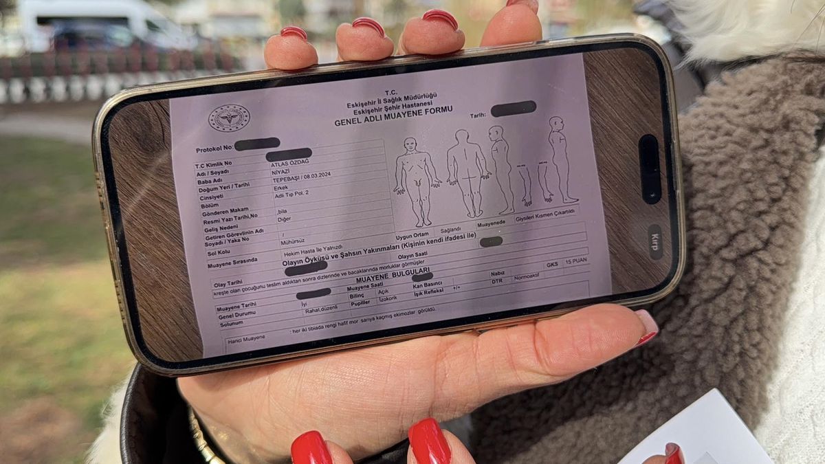 Kreşte Darp İddiası: Anne Savcılığa Başvurdu