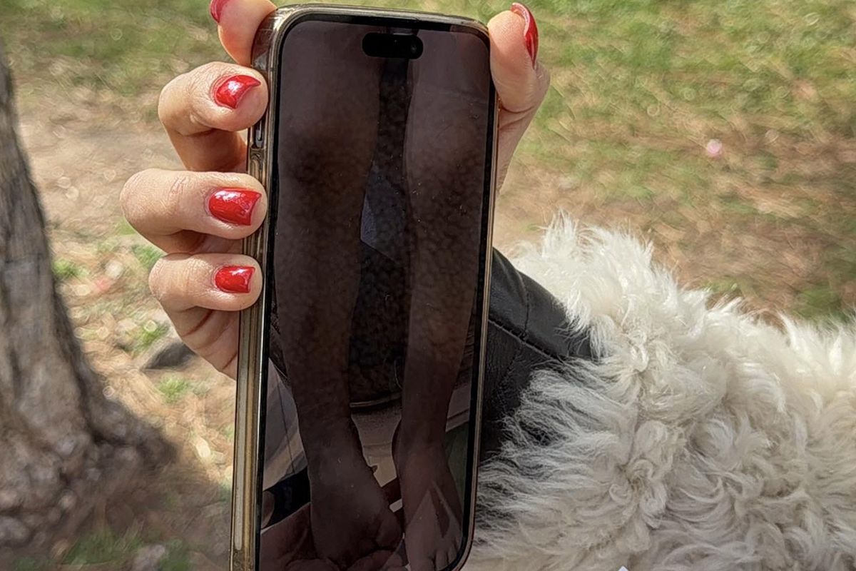 Kreşte şiddet iddiası: Çocuğunun vücudunu gören anne, savcılığa koştu