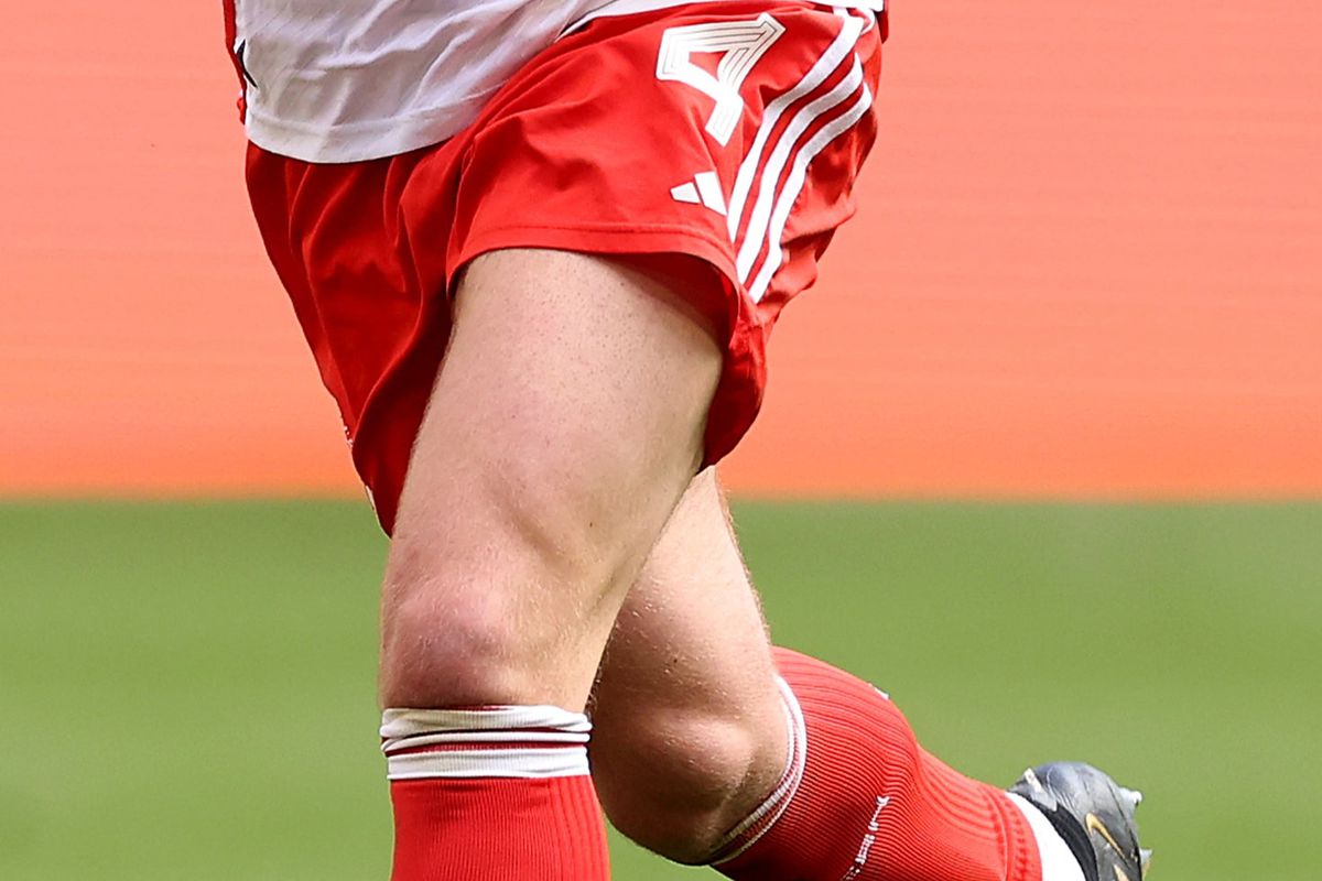 Yıldız futbolcu cinsiyet mi değiştirdi? Kulübünden fotoğraflı yanıt