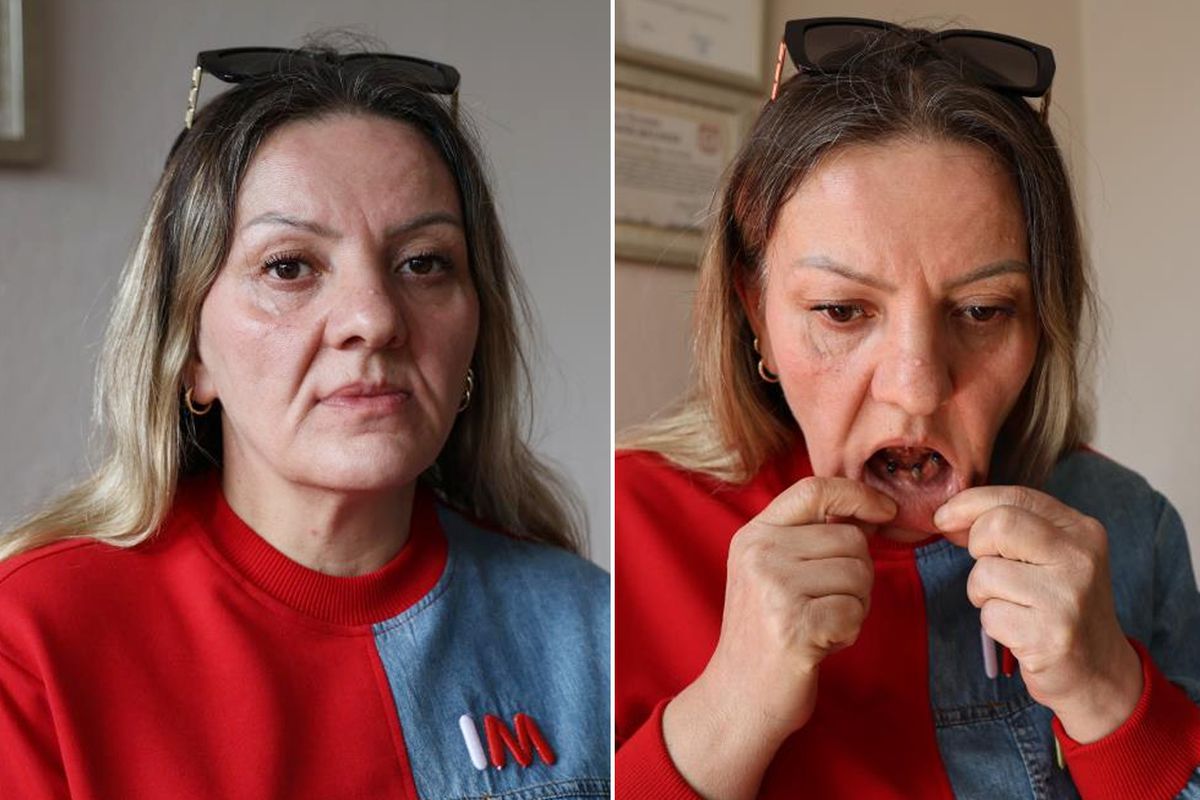 Diş ağrısı şikayetiyle gitti, 25 dişinden oldu