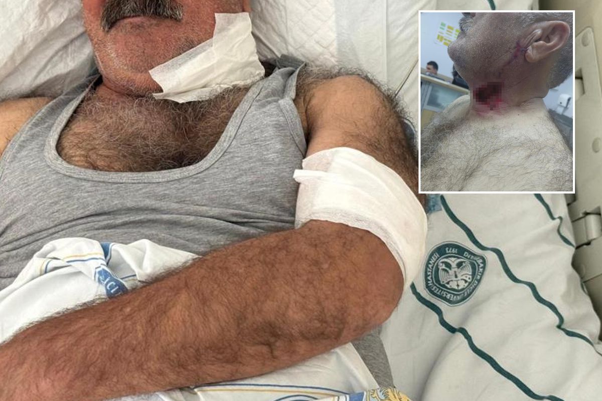 Severek beslediği hayvan bu hale getirdi