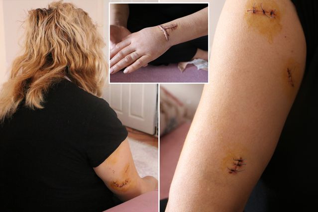 Dini nikahlı eşi 30 yerinden bıçakladı: Yarım kalan işini tamamlayacak