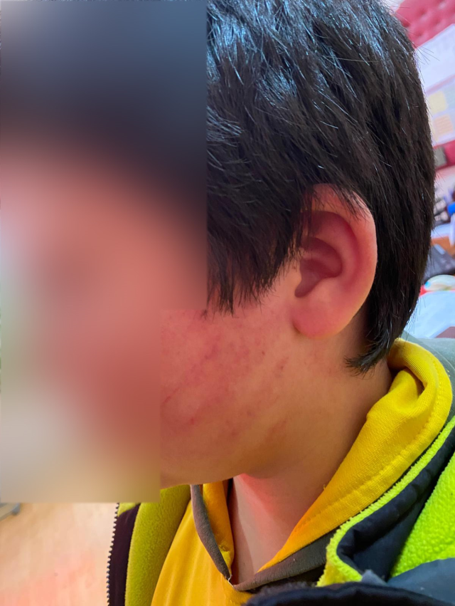 Bu kadarına da pes! Veliler okulda 8 yaşındaki çocukları dövdü