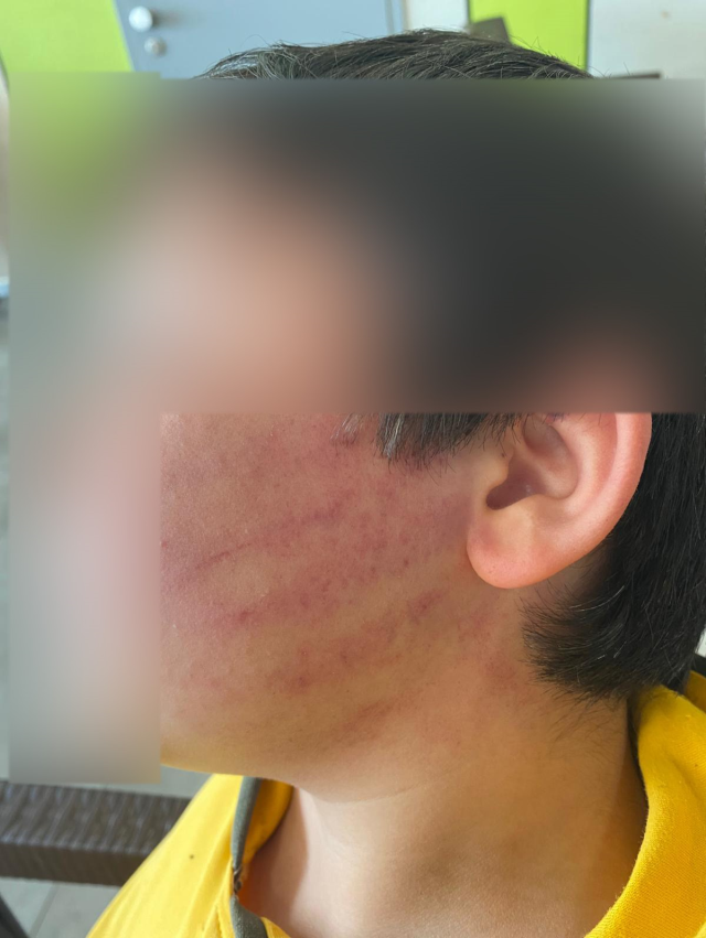 Bu kadarına da pes! Veliler okulda 8 yaşındaki çocukları dövdü