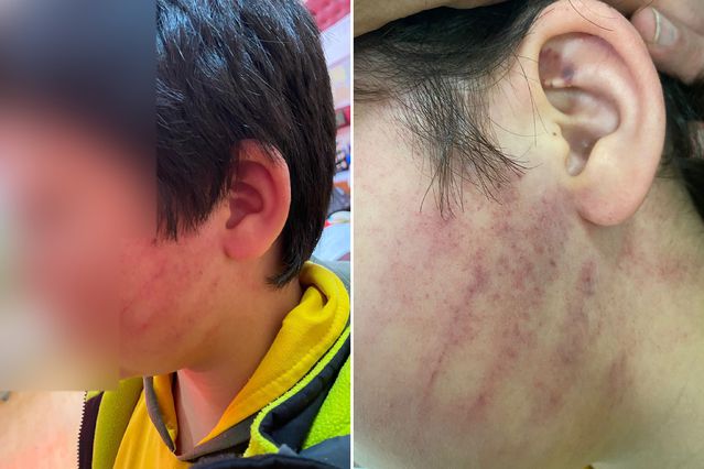 Bu kadarına da pes! Veliler okulda 8 yaşındaki çocukları dövdü