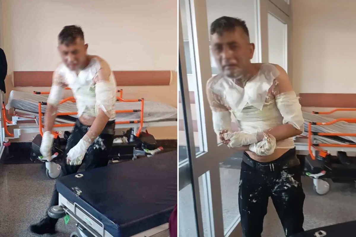 Engelli vatandaşı benzin döküp yakan vicdansıza verilen ceza belli oldu
