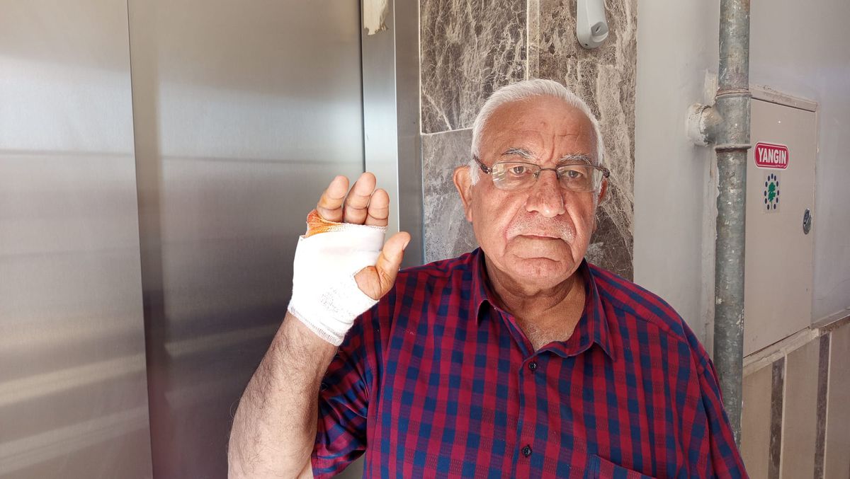 Komşusunun ısırdığı parmağı ampute edildi