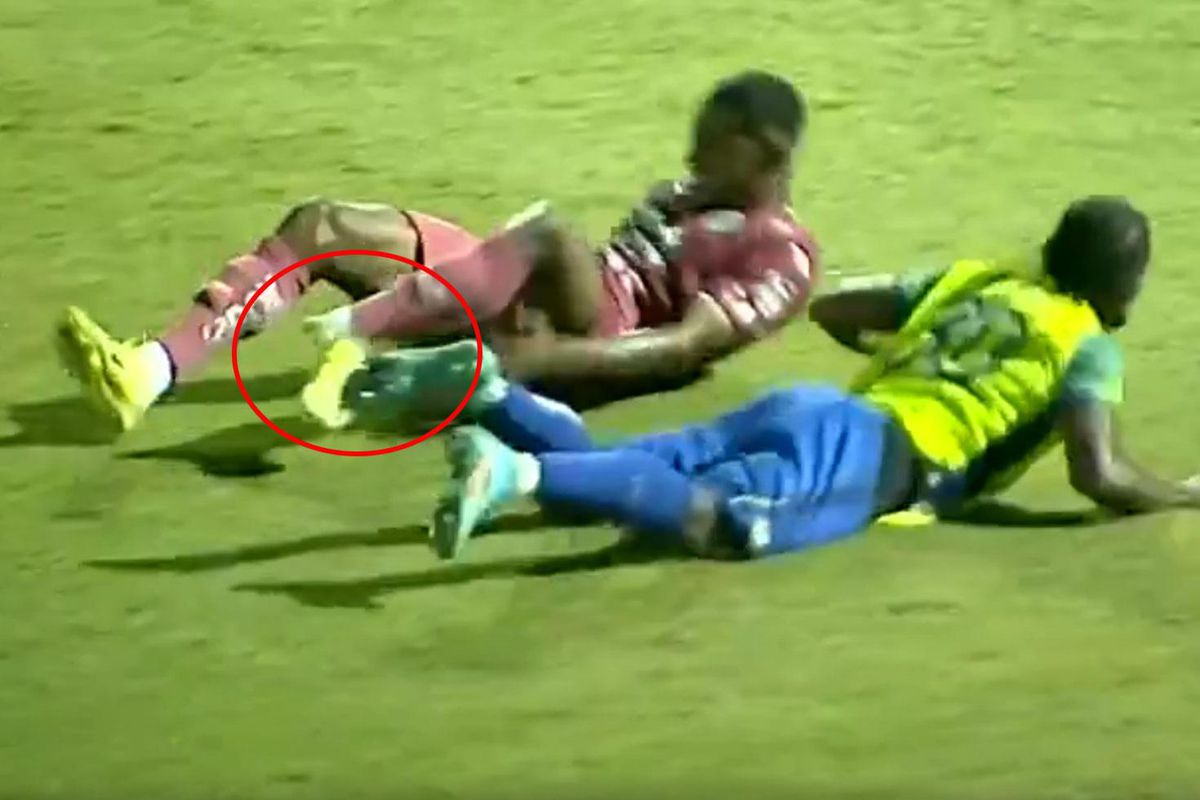 Genç futbolcunun bacağı kırıldı! O anlar kamerada 
