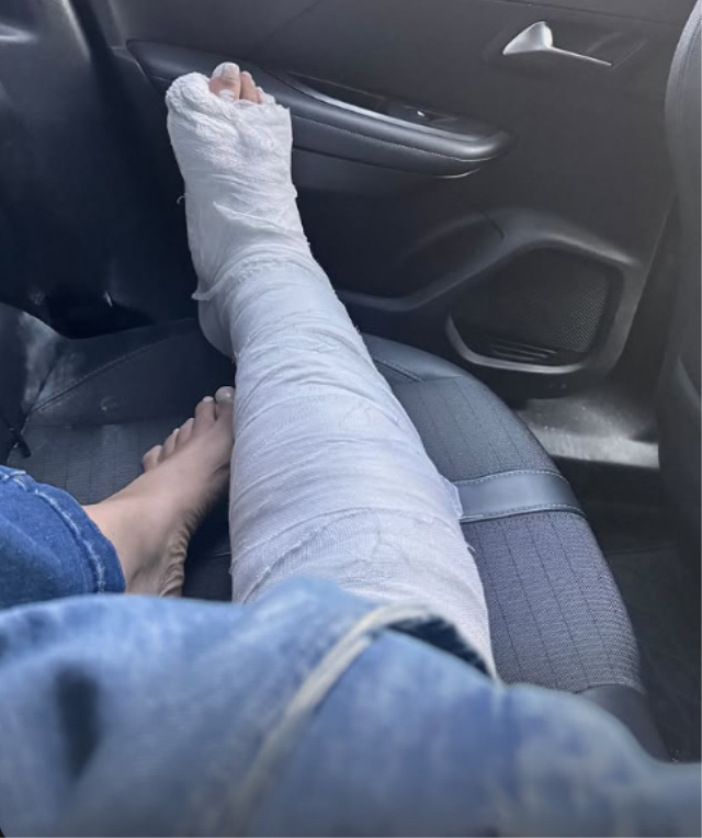 Ayağını kıran Sevda Demirel'in hastanedeki zor anları! Arkadaşına böyle sitem etti