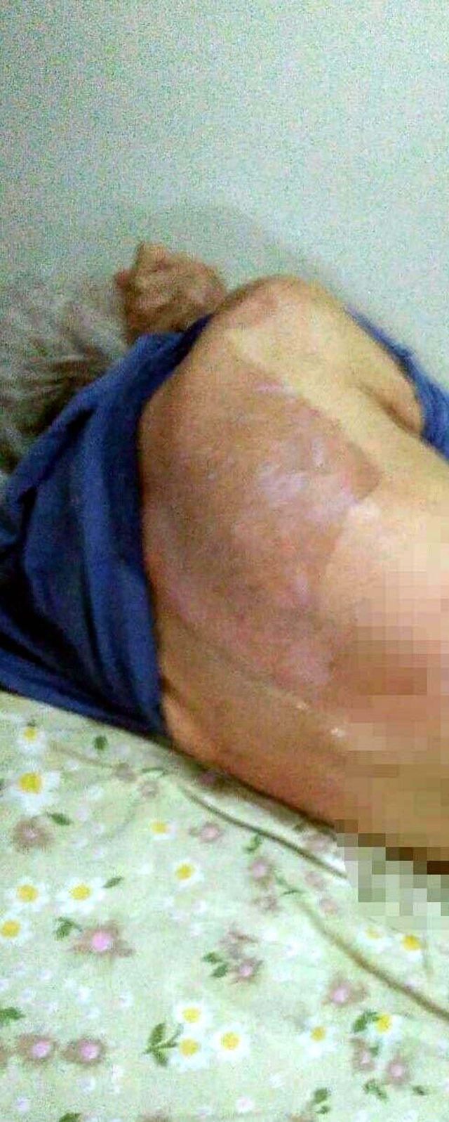 Yaşlı Kadının Ölümünde Doktora Para Cezası