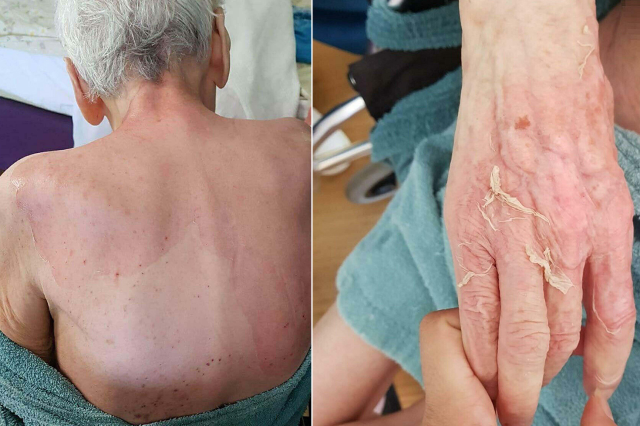 Yaşlı Kadının Ölümünde Doktora Para Cezası