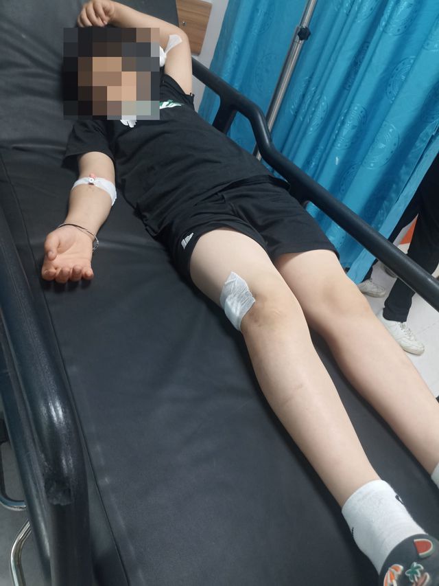 Çocukların elleri tetikte! 9 yaşında parkta vuruldu