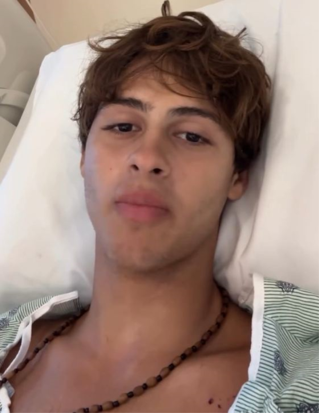 Survivor'da bacağını kaybeden yarışmacının son hali