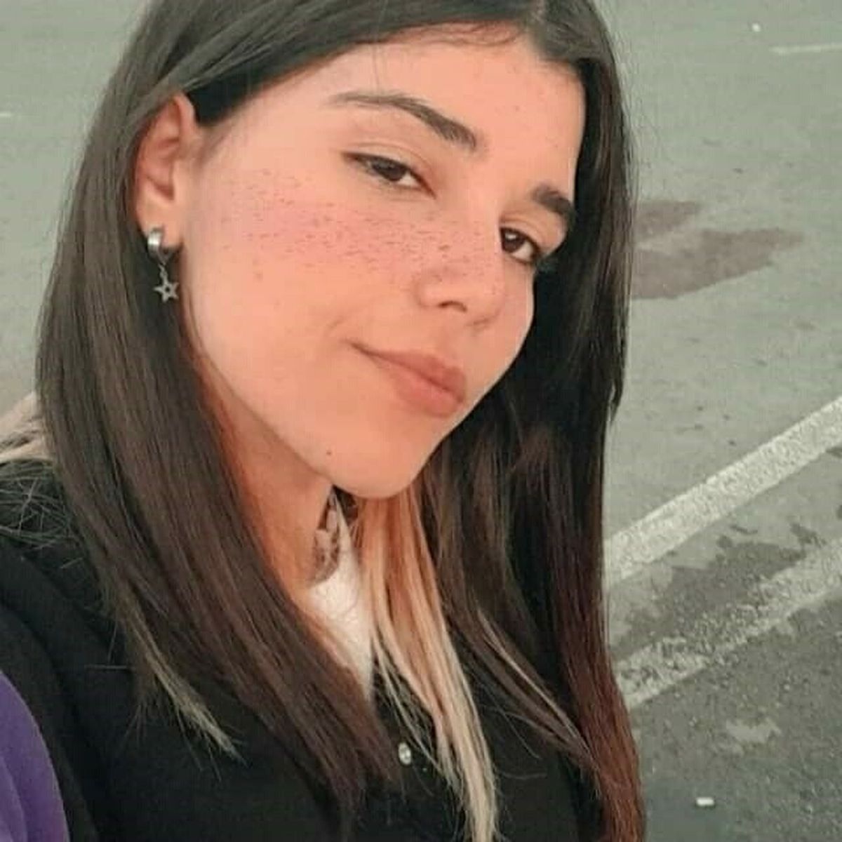 Ünzile Naz\'a Acil Mama Desteği İhtiyacı