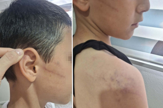 Babasının, öğretmeninden harçlık istedi diye darbettiği çocuk, devlet korumasına alındı