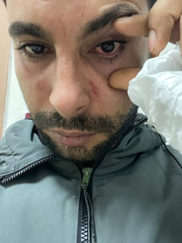Hastasına yumruk atan doktora dava